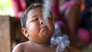 2 yaşında iken sigaraya başlamıştı! Şimdi ise görenleri şaşırtıyor!