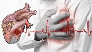 Kalp krizi nedir? Kimler kalp krizi geçirme riski altında?