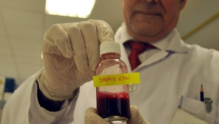 Türk bilim adamları tamamen yerli yapay kan üretti