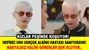 Hepimiz onu Albino hastası biliyorduk!