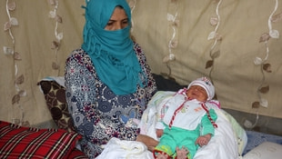 Şanlıurfada Suriyeli bir bebek 24 parmaklı doğdu