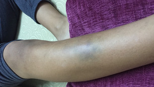 Bursa'da öğretmenin öğrenciyi darbettiği iddiası