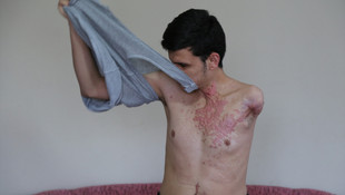 Savaş hem gözlerini hem ailesini aldı