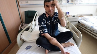 Antalyada çift kol nakli yapılan hasta taburcu edildi