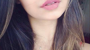 Motosikletin çarptığı üniversiteli yaşam mücadelesi veriyor