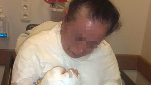 Uyuyan eşini kaynar su dökerek yaraladığı iddiası