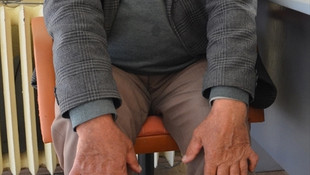 24 parmağıyla herkesi şaşırtıyor