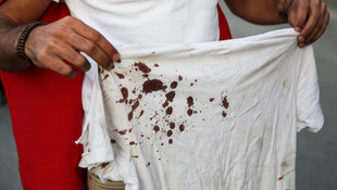 Üzerindeki şehit kanıyla demokrasi nöbetini sürdürdü