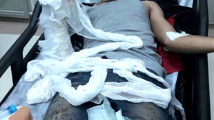 Karakola atmaya çalıştığı EYP elinde patladı