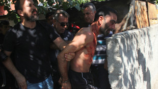 Kendisini yakalamak isteyen polisi bıçakla yaraladı