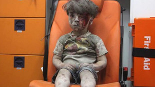 Suriyenin Halep kentine yapılan hava saldırısıyla yaralanan Ümran bebek öldü mü?