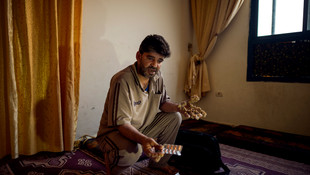 Gazzeli ağaç adam 6 yıldır ameliyat edilmeyi bekliyor