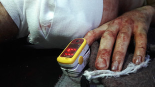 Kuşatma altındaki Madaya'da böbrek hastaları yardım bekliyor