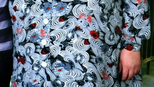 Obezite hastası kadın sağlığına kavuşmak istiyor