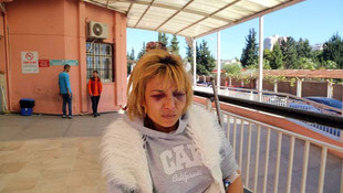 Adanada bulaşığı makinede yıkamak isteyen eşini bu hale getirdi