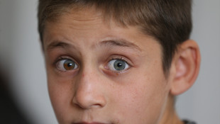 Bu gözler görenleri şaşırtıyor