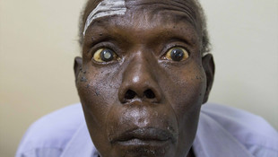 Yeryüzü Doktorları Uganda'da yüzlerce hastaya ışık oldu