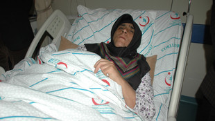 Beyin kanaması geçiren hasta ameliyatsız tedavi edildi