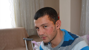 Kayseri'deki terör saldırısı