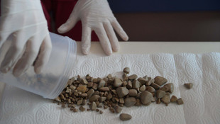 Mesanesinden binden fazla taş çıktı