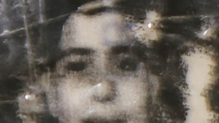 Pompalı tüfekle başından vurulan çocuk ağır yaralandı