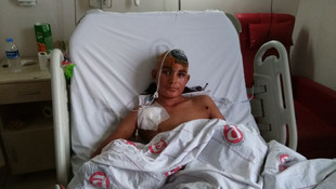 Sokak köpeklerinin saldırdığı Suriyeli çocuk ölümden döndü