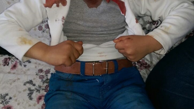 Patnos'ta başıboş köpekler 15 kişiyi yaraladı