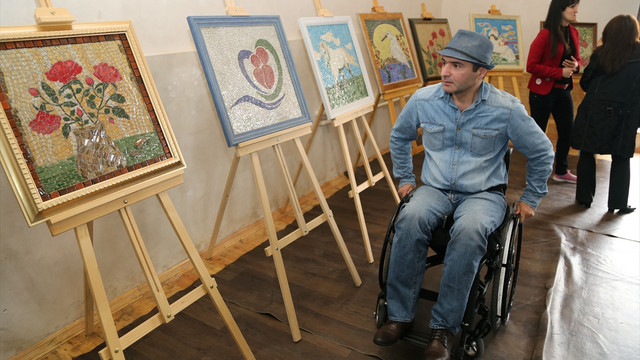 TİKA'dan Azerbaycanlı engellilere destek