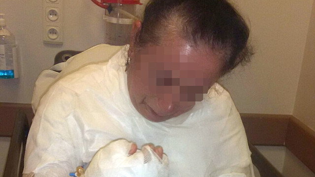 Uyuyan eşini kaynar su dökerek yaraladığı iddiası