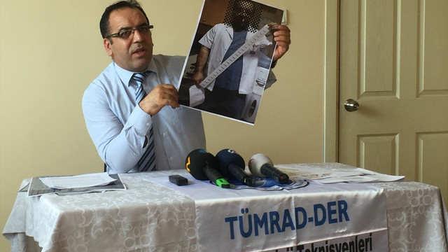 ERÜ'de 12 teknisyenin kansere yakalandığı iddiası