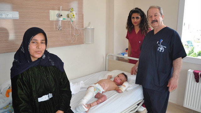 Mısır tarlasında yanan çocuk hayata tutundu