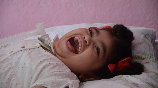 Anne sevgisi küçük kızı hayata bağladı