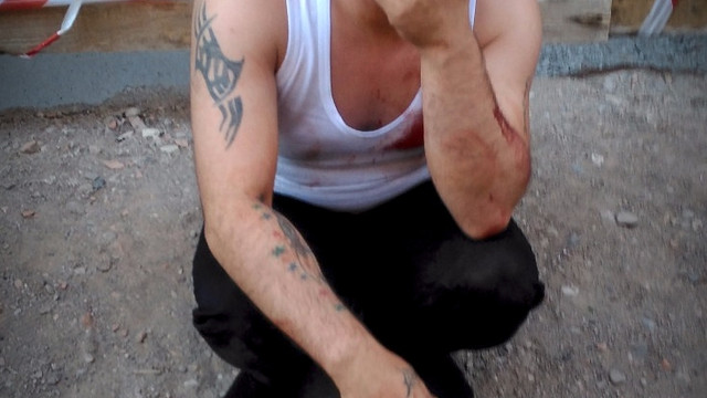 Bıçak yarasıyla metrelerce yürüyüp yardım istedi