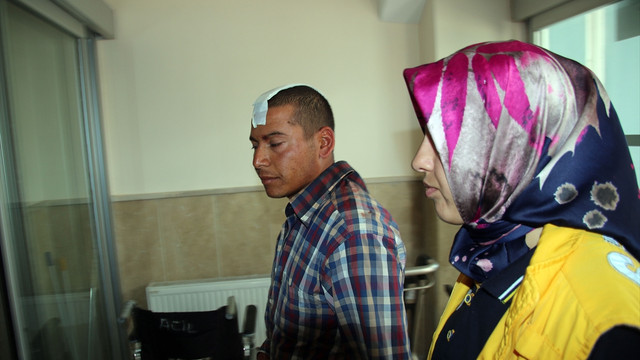 Sivas'ta taşlı, sopalı kavga: 7 yaralı