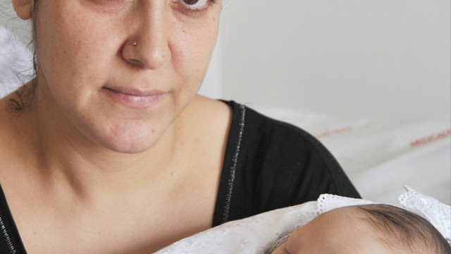 45 günlük bebekten 300 gram kist alındı