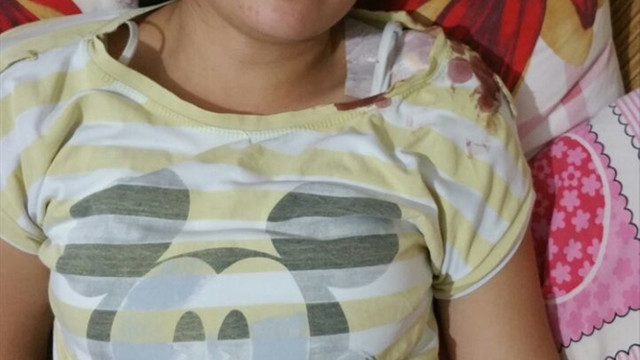 Bahçede oturan genç kıza kurşun isabet etti