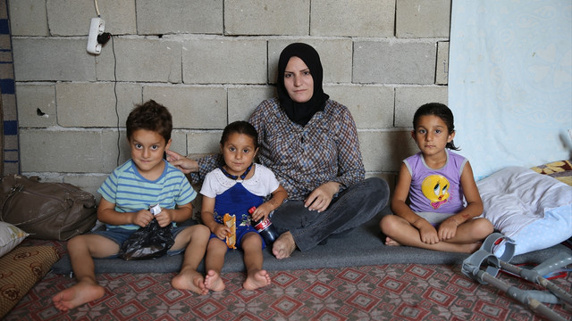 Bombalanan hastanede kopan bacağı için protez bekliyor