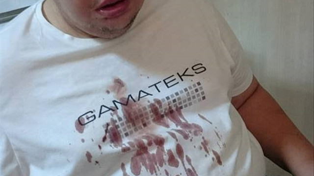 Çarptı diye engelli gencin burnunu kırdı