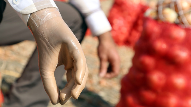 Elini kaybetti ama hayalinden vazgeçmedi