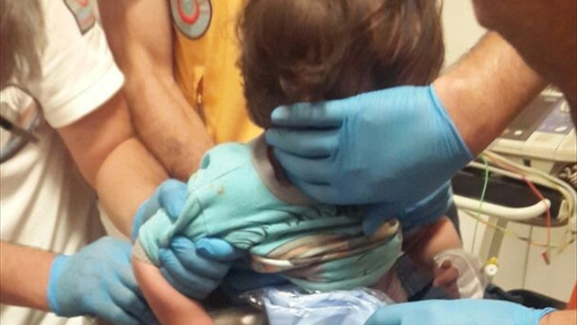 Elini kıyma makinesine kaptıran bebeği itfaiye kurtardı