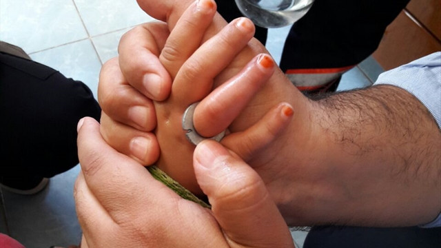 Metal pula sıkışan parmağını itfaiye kurtardı