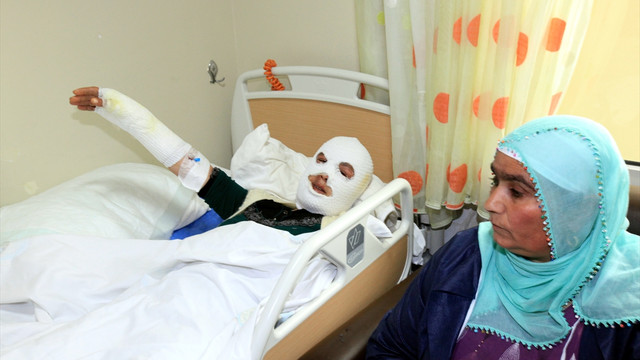 Mutfağındaki yangını söndürürken yaralandı