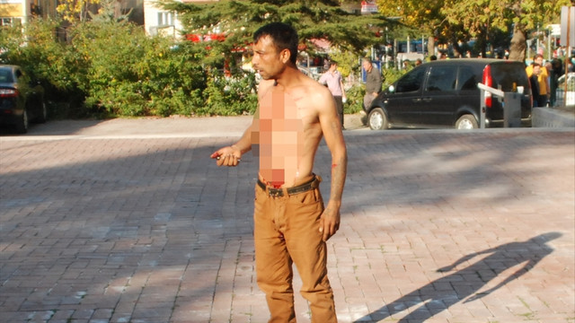 Valilik binası önünde kendisini yaraladı