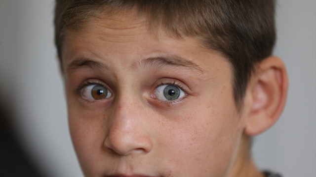 Bu gözler görenleri şaşırtıyor