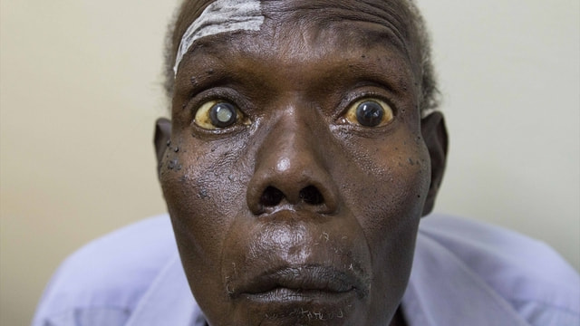 Yeryüzü Doktorları Uganda'da yüzlerce hastaya ışık oldu