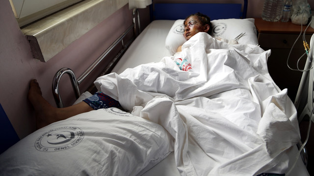 Halep'te yaralanan Merve, en büyük acıyı kalbinde yaşıyor