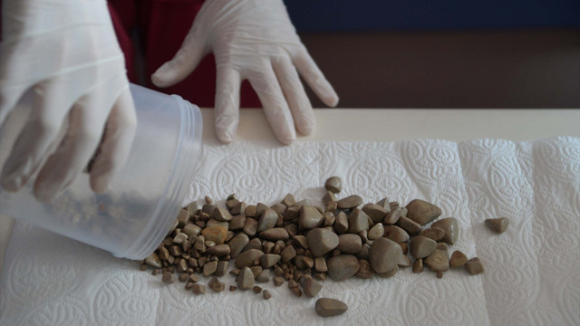 Mesanesinden binden fazla taş çıktı