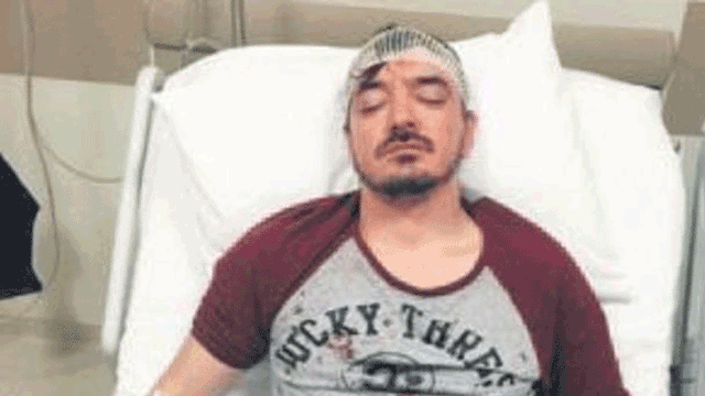 Sanatçı Orhan Ölmez 5 yerinden bıçaklandı
